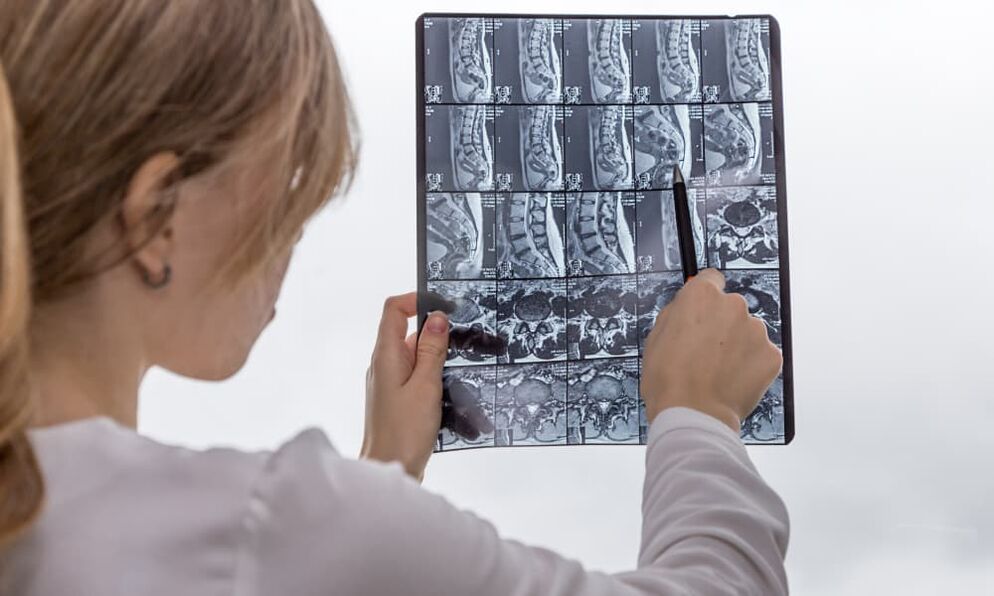 MRI will help the doctor identify osteochondrosis and prescribe treatment. 