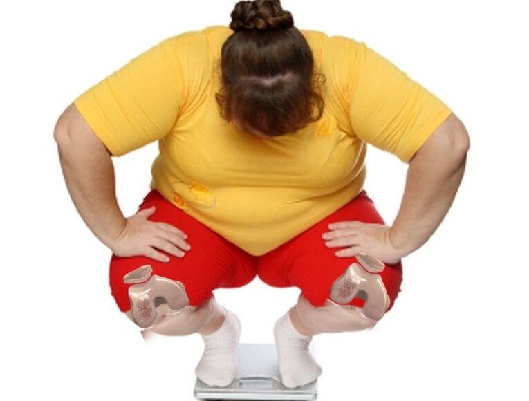 Among patients suffering from osteoarthritis, the majority are overweight or obese.