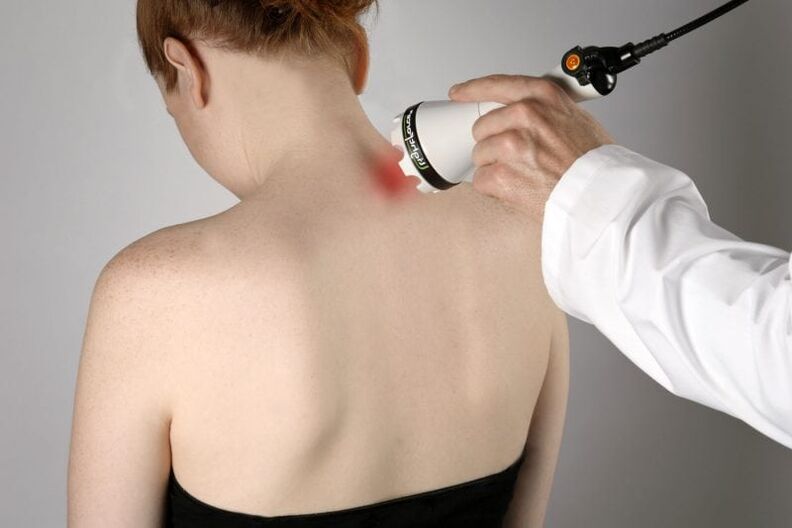 Laser treatment of cervical osteochondrosis in women.